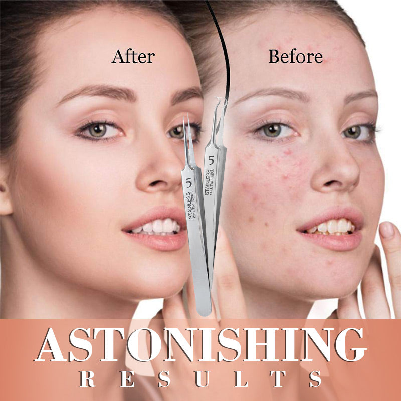 Professional Beauty Salon Tweezers | Precision Slant & Pointed Tips for Brows & Lashes | Essential for Makeup Artists & Home Kits 🎆✨