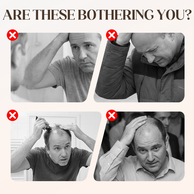 🧢Unisex Hip-Hop Wig Hat – Grunge Style, Soft & Comfortable Fit for Parties, Cosplay and Costumes ✨